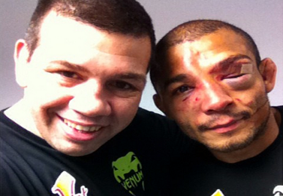 ... And Bruised, But Victorious, Jose Aldo Post-Fight | BJPENN.COM