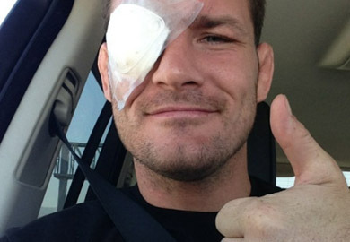 Michael Bisping Eyes Bout with Cung Le After Eye Heals