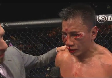 PHOTO | Cung Le Following Tough Bout With Bisping