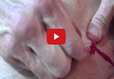 Bas Rutten Sews Up His Own Leg In Graphic Video