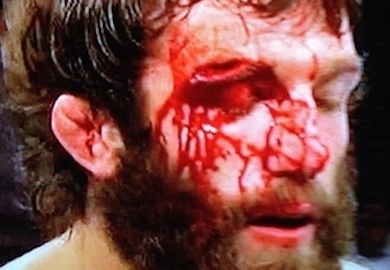 PHOTO | Chiesa’s Fight Stopping Cut