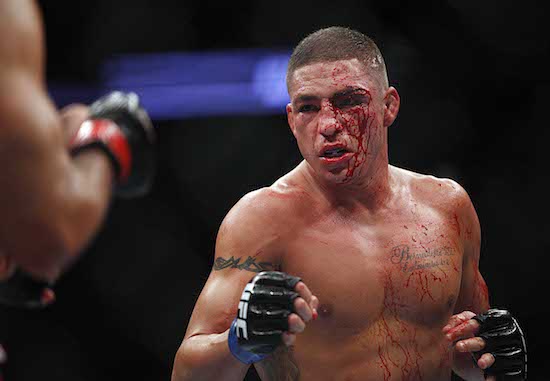 MMA: UFC 166-Melendez vs Sanchez