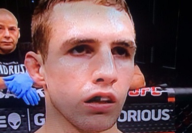 PHOTO | The Eerie Stare Of Rory MacDonald
