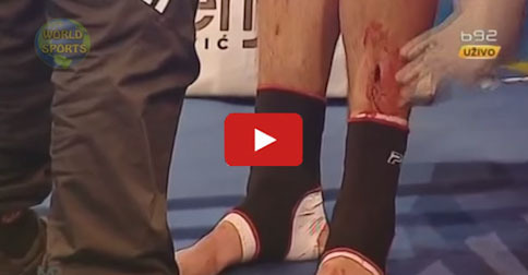 Former NBA star loses kickboxing match due to nasty, bloody, gruesome leg wound
