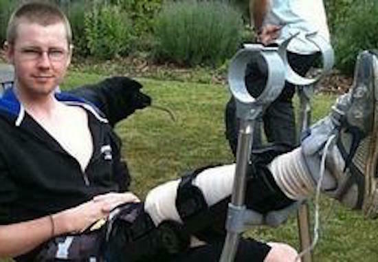 UK Fighter having pioneering donor leg operation following motorcycle crash