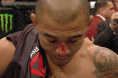 Jose Aldo