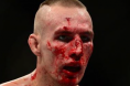 Rory MacDonald bloody