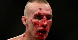 Rory MacDonald bloody