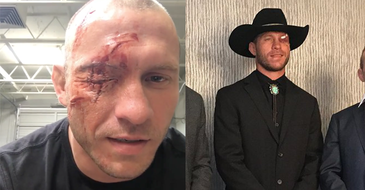 Donald Cowboy Cerrone eye injury makeup