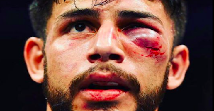 Yair Rodriguez