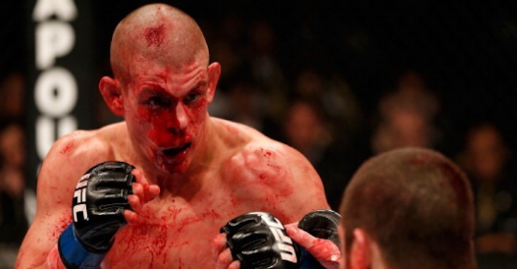 Joe Lauzon