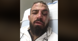 Mike Perry vs Santiago Ponzinibbio at UFC on Fox 26