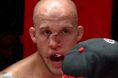Blake Perry, MMA, Broken Nose, Smashed