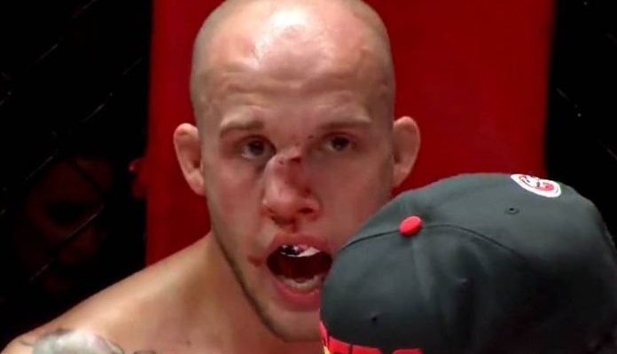 Blake Perry, MMA, Broken Nose, Smashed