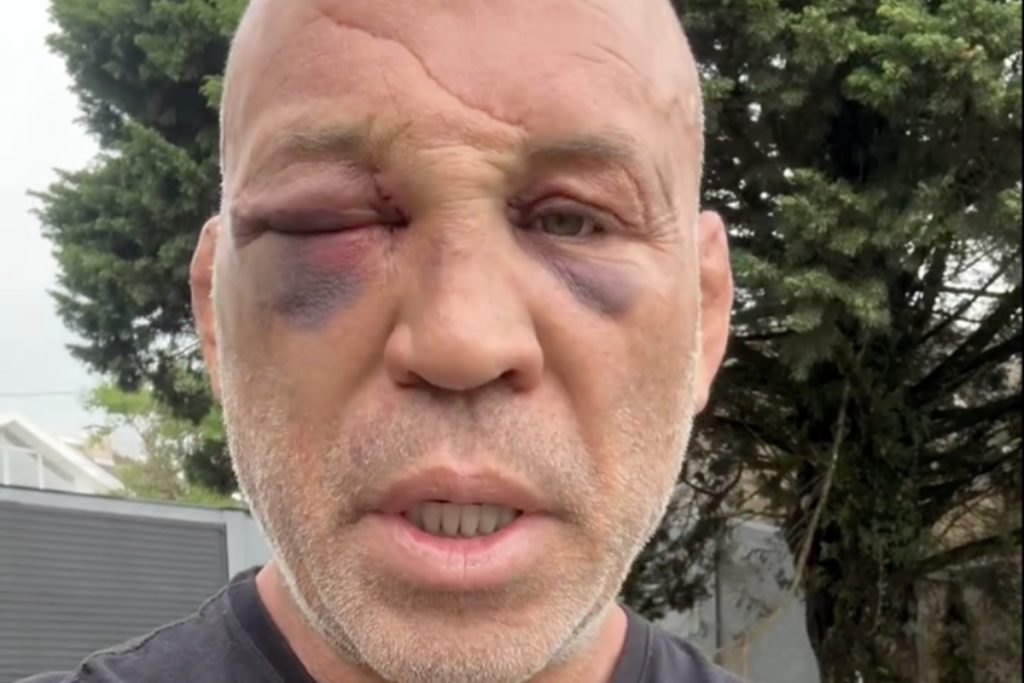 Wanderlei Silva after post-fight KO