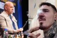 Dana White Tom Aspinall Eye