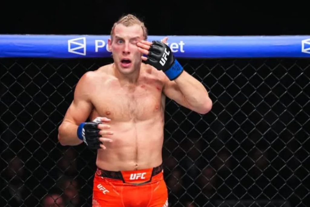 Paddy Pimblett wipes eye at UFC 324