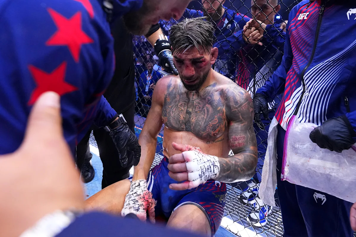 Dana White assumes Ilia Topuria suffered broken orbital at UFC Freedom 250: “He’s busted up”