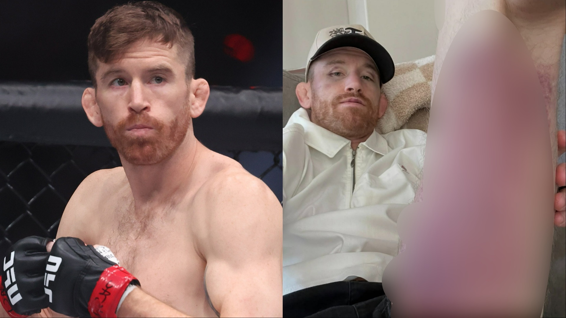 Cory Sandhagen shows off gruesome UFC 329 injury in first post-fight statement