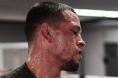 Nate Diaz